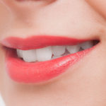 歯の黄ばみの原因酸蝕歯